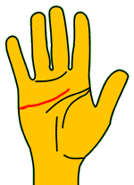 Lnea del corazn alejada